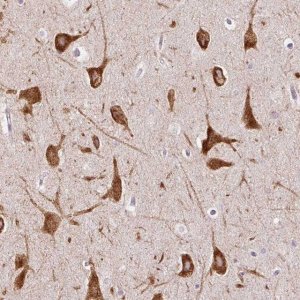 Anti-FMC1 antibody produced in rabbit 