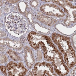 Anti-FMO4 antibody produced in rabbit 