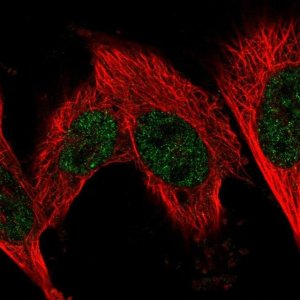 Anti-FN3KRP antibody produced in rabbit 