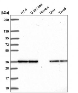 Anti-FN3KRP antibody produced in rabbit 
