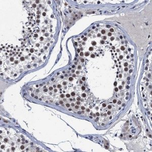 Anti-FNBP4 antibody produced in rabbit 