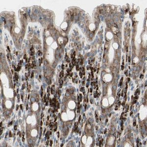 Anti-FNDC3A antibody produced in rabbit HPA008927-100UL