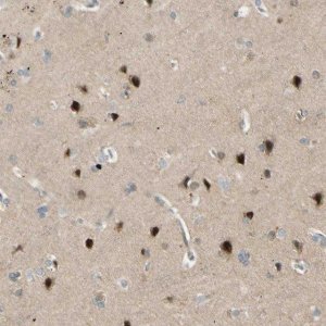 Anti-FNDC3B antibody produced in rabbit 
