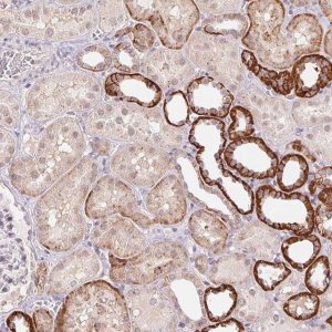 Anti-FNDC4 antibody produced in rabbit 