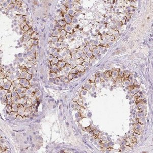 Anti-FNDC7 antibody produced in rabbit 