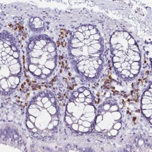 Anti-FNTB antibody produced in rabbit 