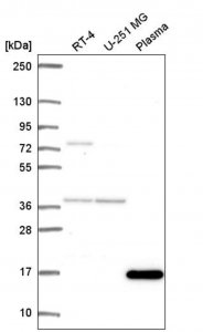 Anti-FOXL2NB antibody produced in rabbit HPA061017-100UL