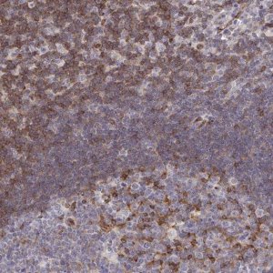 Anti-FOXN3 antibody produced in rabbit 