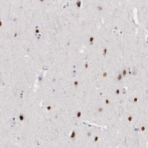 Anti-FOXP2 antibody produced in rabbit 