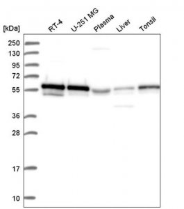 Anti-FOXP3 antibody produced in rabbit 