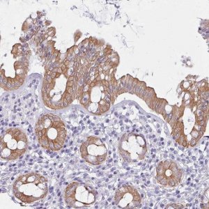 Anti-FPGS antibody produced in rabbit 