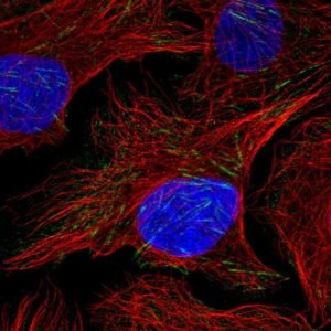 Anti-FRMD1 antibody produced in rabbit 