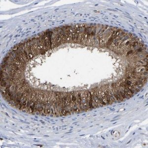 Anti-FRRS1 antibody produced in rabbit 