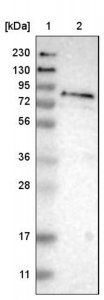 Anti-FRRS1 antibody produced in rabbit 