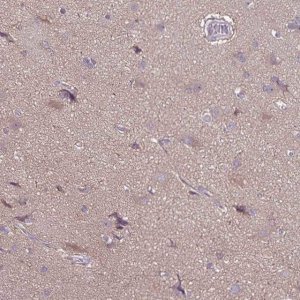 Anti-FSD1 antibody produced in rabbit 
