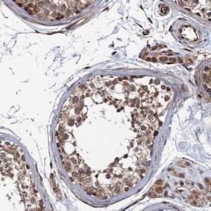 Anti-FSIP1 antibody produced in rabbit 