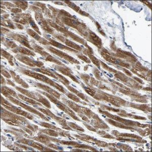 Anti-FST antibody produced in rabbit HPA018155-100UL