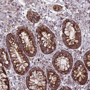 Anti-FSTL4 antibody produced in rabbit 