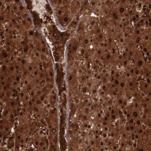 Anti-FTSJ1 antibody produced in rabbit 