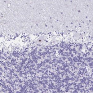 Anti-FTSJ3 antibody produced in rabbit 