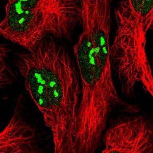 Anti-FTSJ3 antibody produced in rabbit 