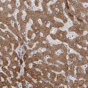 Anti-GABBR1 antibody produced in rabbit 