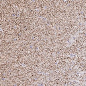 Anti-GABBR2 antibody produced in rabbit 
