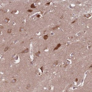 Anti-GABRB1 antibody produced in rabbit 