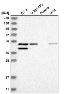 Anti-GAD1 antibody produced in rabbit HPA031949-100UL
