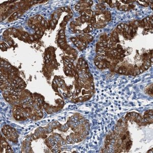 Anti-GADL1 antibody produced in rabbit 