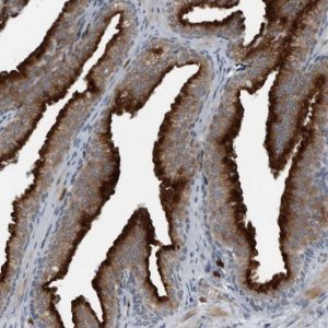 Anti-GAK antibody produced in rabbit 