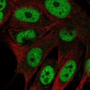 Anti-GAL3ST4 antibody produced in rabbit 