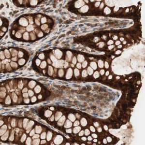 Anti-GALE antibody produced in rabbit HPA007340-100UL