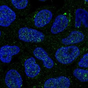 Anti-GALNT14 antibody produced in rabbit 