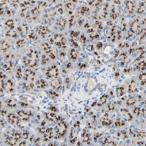 Anti-GALNT2 antibody produced in rabbit 
