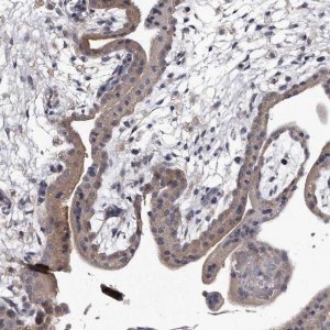 Anti-GAPVD1 antibody produced in rabbit 