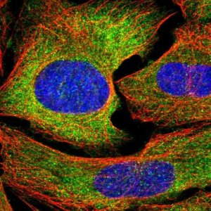 Anti-GAPVD1 antibody produced in rabbit HPA029386-100UL