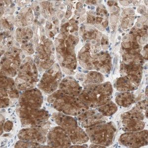 Anti-GART antibody produced in rabbit 