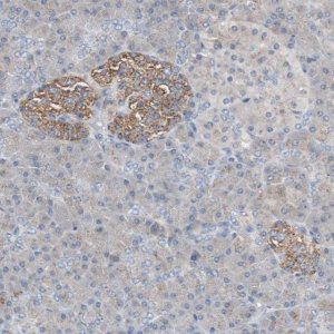 Anti-GBA antibody produced in rabbit 