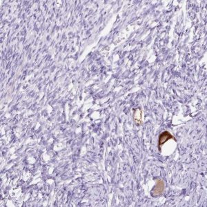 Anti-GBX1 antibody produced in rabbit 