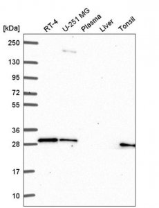 Anti-GBX2 antibody produced in rabbit 