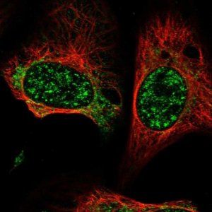 Anti-GCAT antibody produced in rabbit 