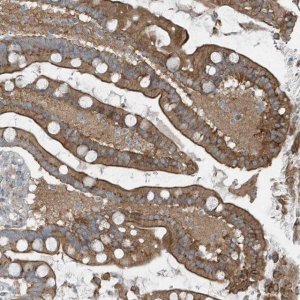Anti-GCC2 antibody produced in rabbit 