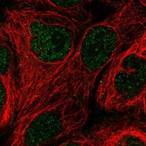 Anti-GCHFR antibody produced in rabbit HPA046258-100UL