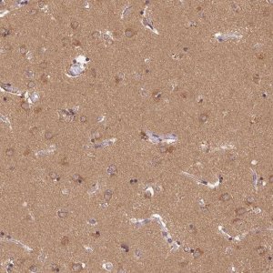 Anti-GDI1 antibody produced in rabbit 