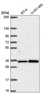 Anti-GEMIN2 antibody produced in rabbit 