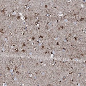 Anti-GFOD2 antibody produced in rabbit 
