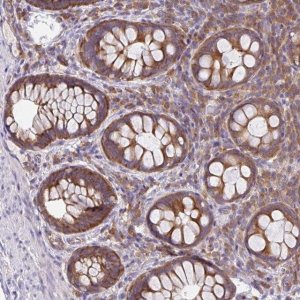 Anti-GFPT2 antibody produced in rabbit 