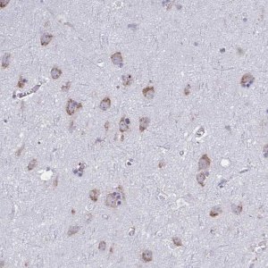 Anti-GFPT2 antibody produced in rabbit HPA059910-100UL