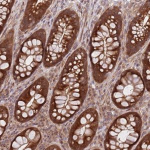 Anti-GGA1 antibody produced in rabbit HPA048280-100UL